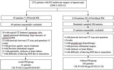 Practical nomogram based on comprehensive CT texture analysis to preoperatively predict peritoneal occult metastasis of gastric cancer patients